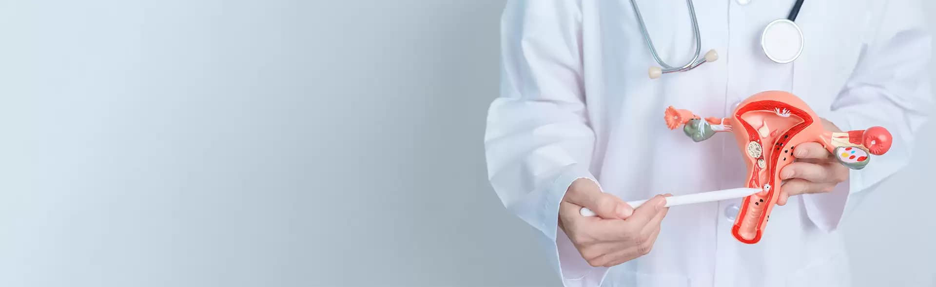 Myomectomy Treatment