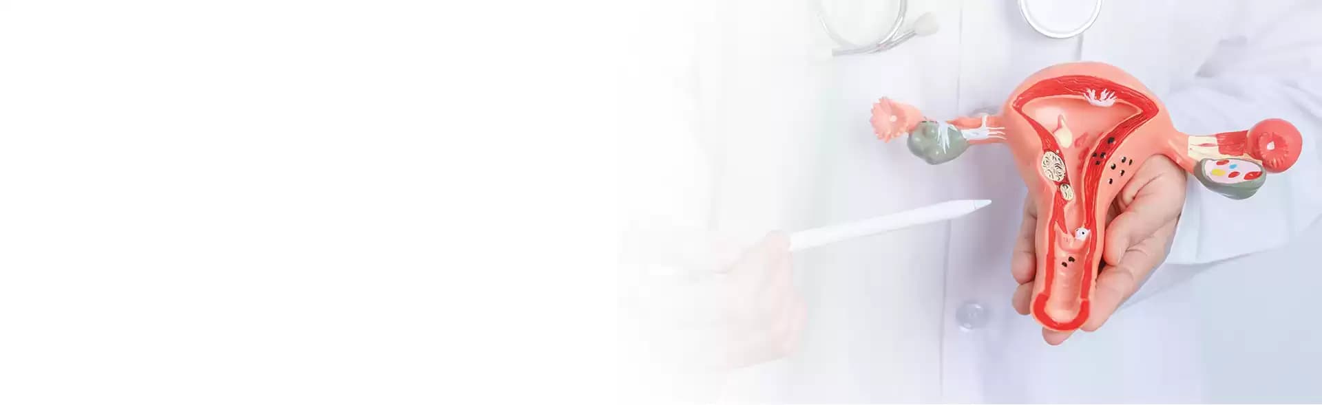 Endometriosis