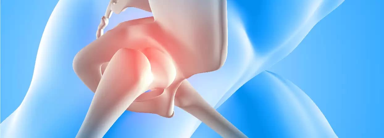 Need of Hip Replacemnet Surgery And Its Benefits
