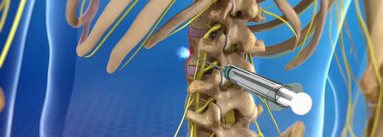 Lumbar Sympathectomy