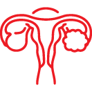 PCOS
