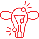 Endometriosis
