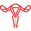 Myomectomy