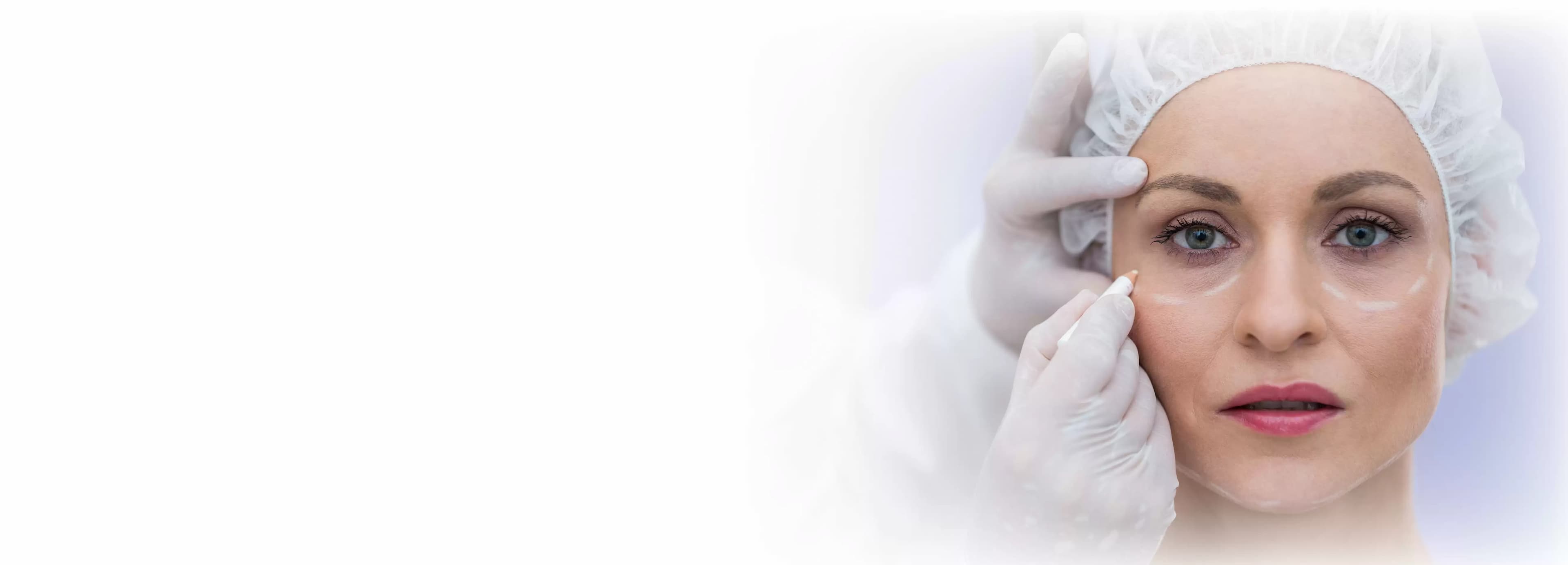 Blepharoplasty