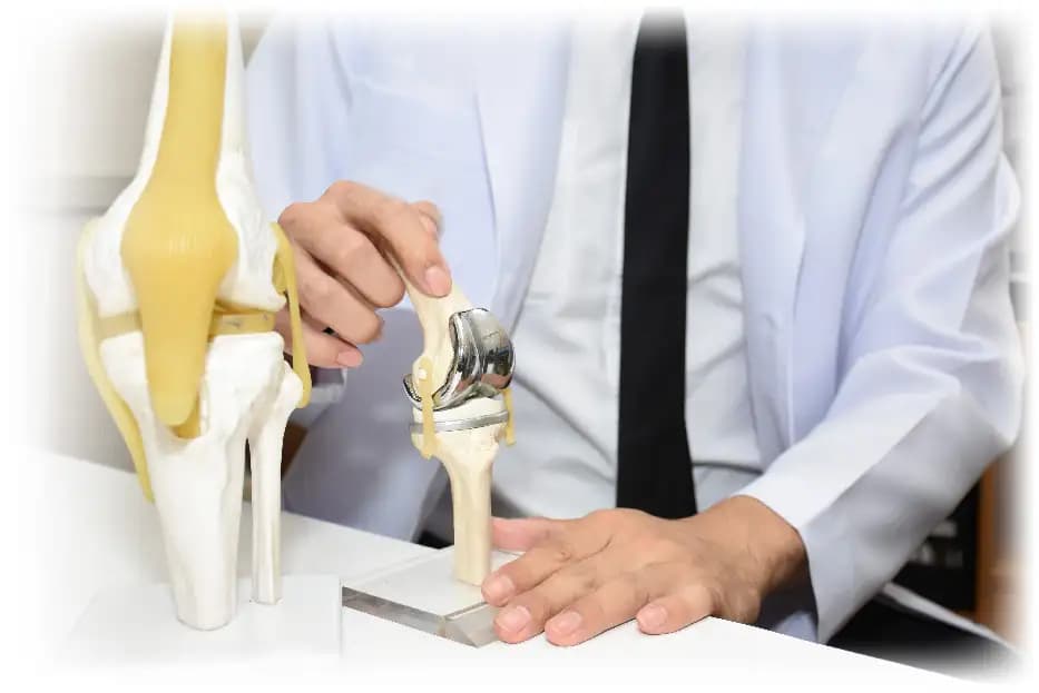 Arthroscopy Surgery