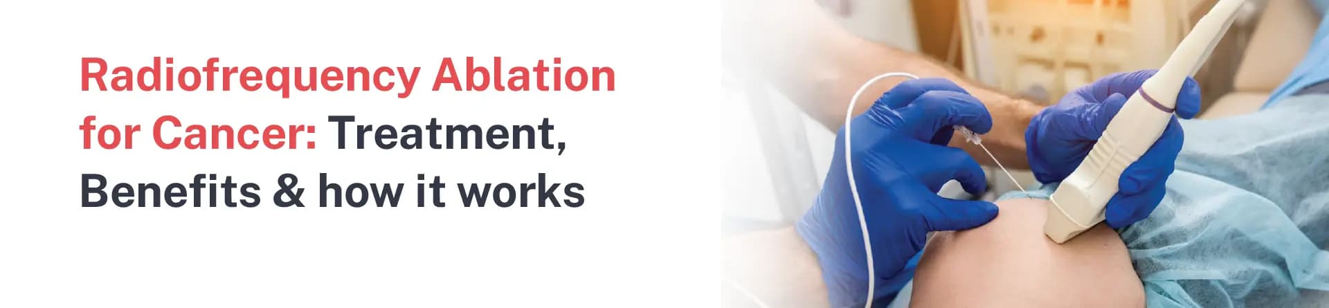 Radiofrequency Ablation for Cancer: Treatment, Benefits & how it works