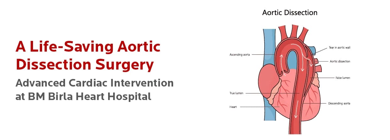 A Life-Saving Aortic Dissection Surgery Advanced Cardiac Intervention