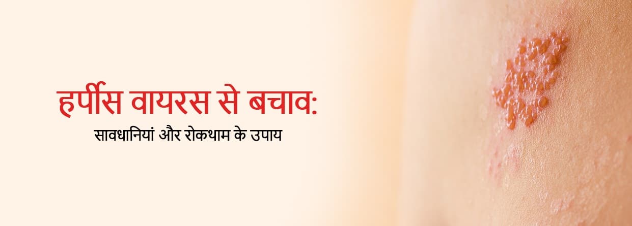 हर्पीस वायरस से बचाव: सावधानियां और रोकथाम के उपाय