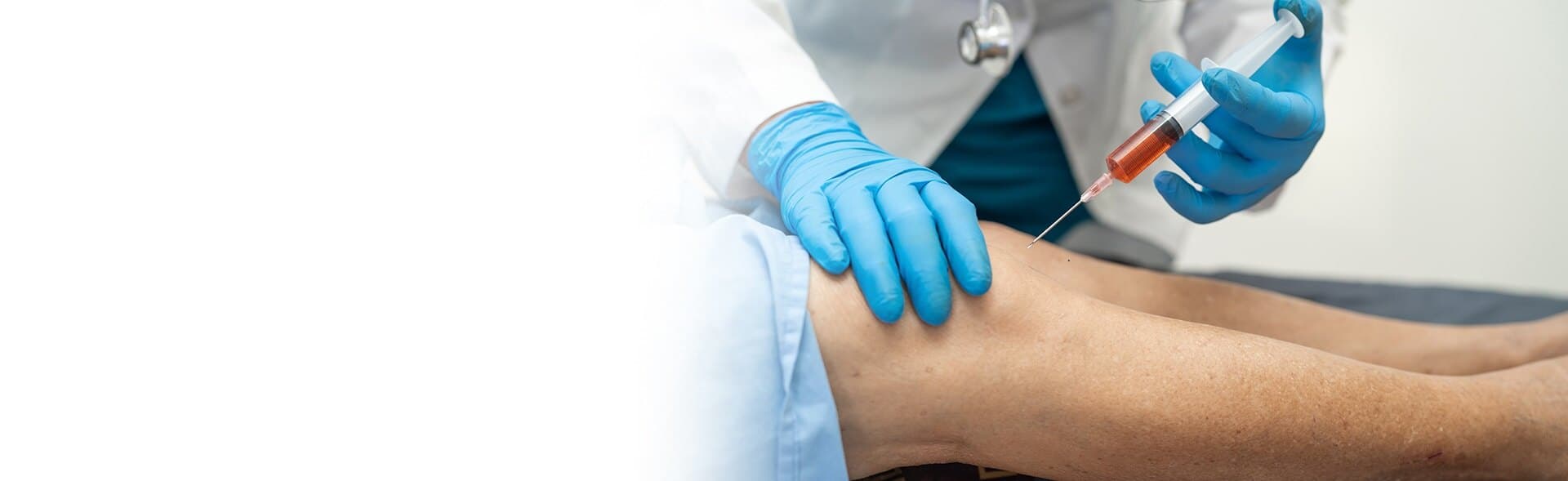 Stem cell therapy
